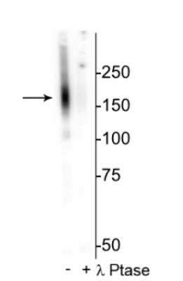 Western Blot: SLC12A3 [p Thr53] Antibody [NBP2-60775]